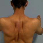 Tips for Eliminating Upper Back Pain