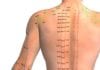 Acupuncture for your Back