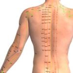 Acupuncture for your Back