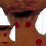 Stop Headaches and Migraines Naturally-Instant Relief Fast!